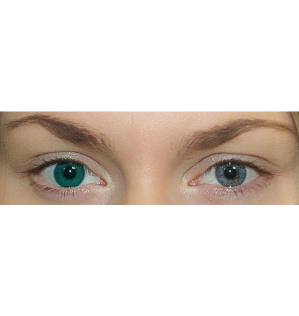 O2KSEE TONE 38 (1 ШТ)